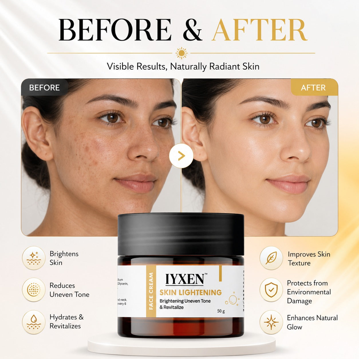 Iyxen Brightening Complex Uneven Tone Dark Spot Face Cream