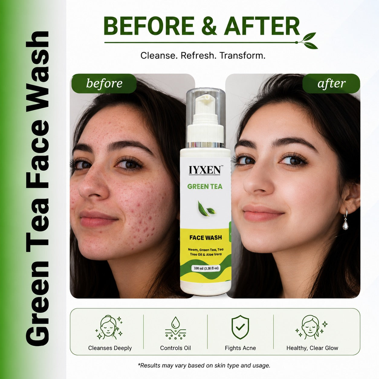 Iyxen Green Tea Neem Aloe Vera Face Wash