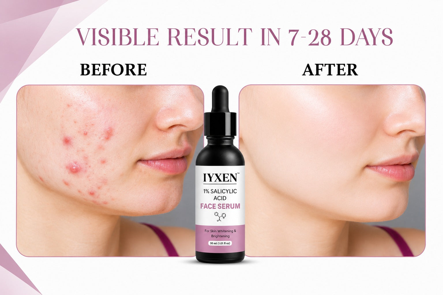 Iyxen 1% Salicylic Acid Brightening Face Serum