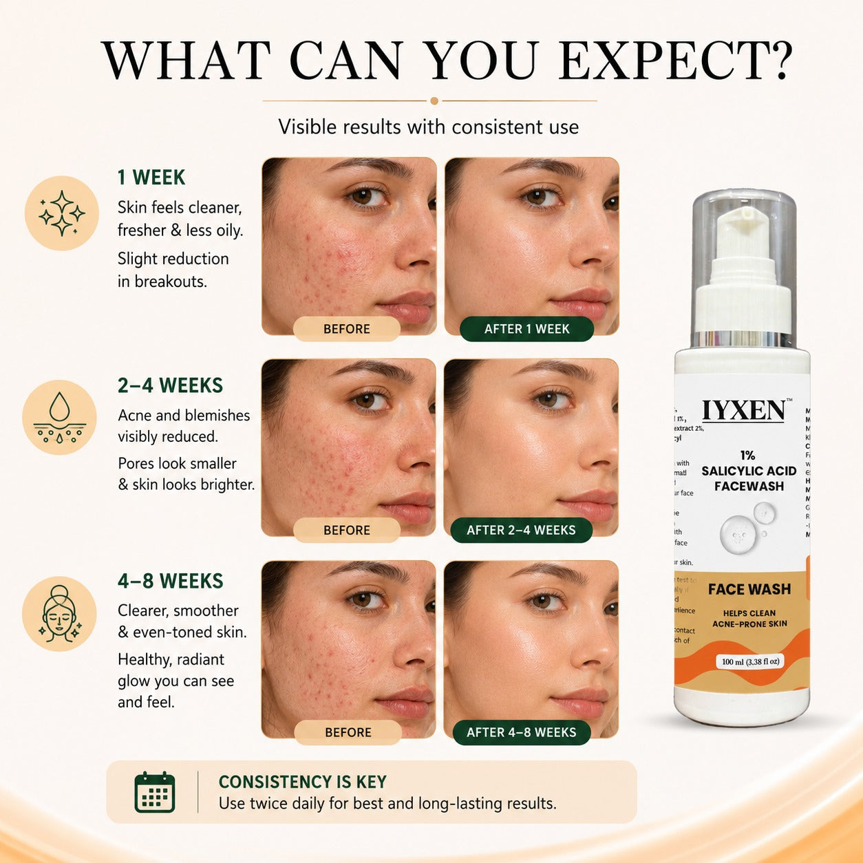 Iyxen 1% Salicylic Acid Face Wash For Acne Prone Skin