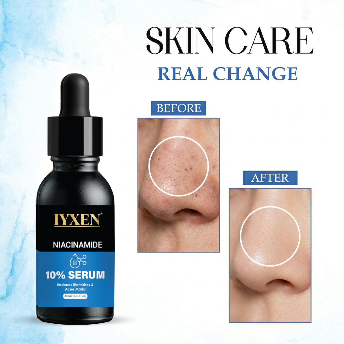 Iyxen Niacinamide 10% Face Serum For Blemishes And Acne Marks