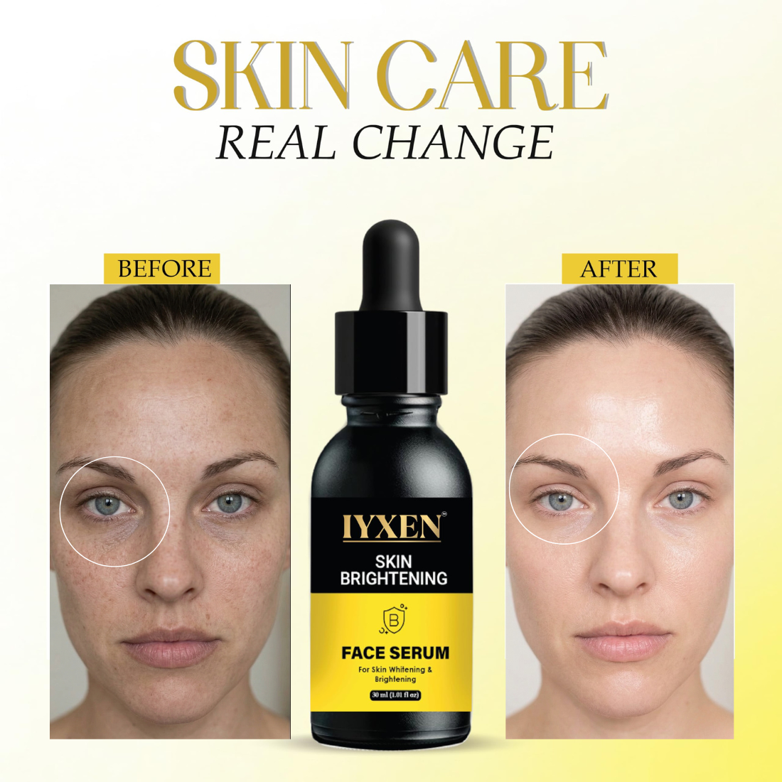 Iyxen Skin Brightening Whitening Face Serum For Dark Spots