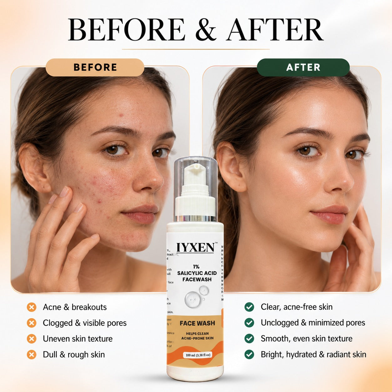 Iyxen 1% Salicylic Acid Face Wash For Acne Prone Skin