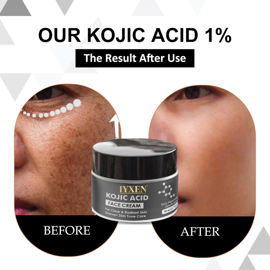 Iyxen Kojic Acid Niacinamide Face Cream For Clear Radiant Skin