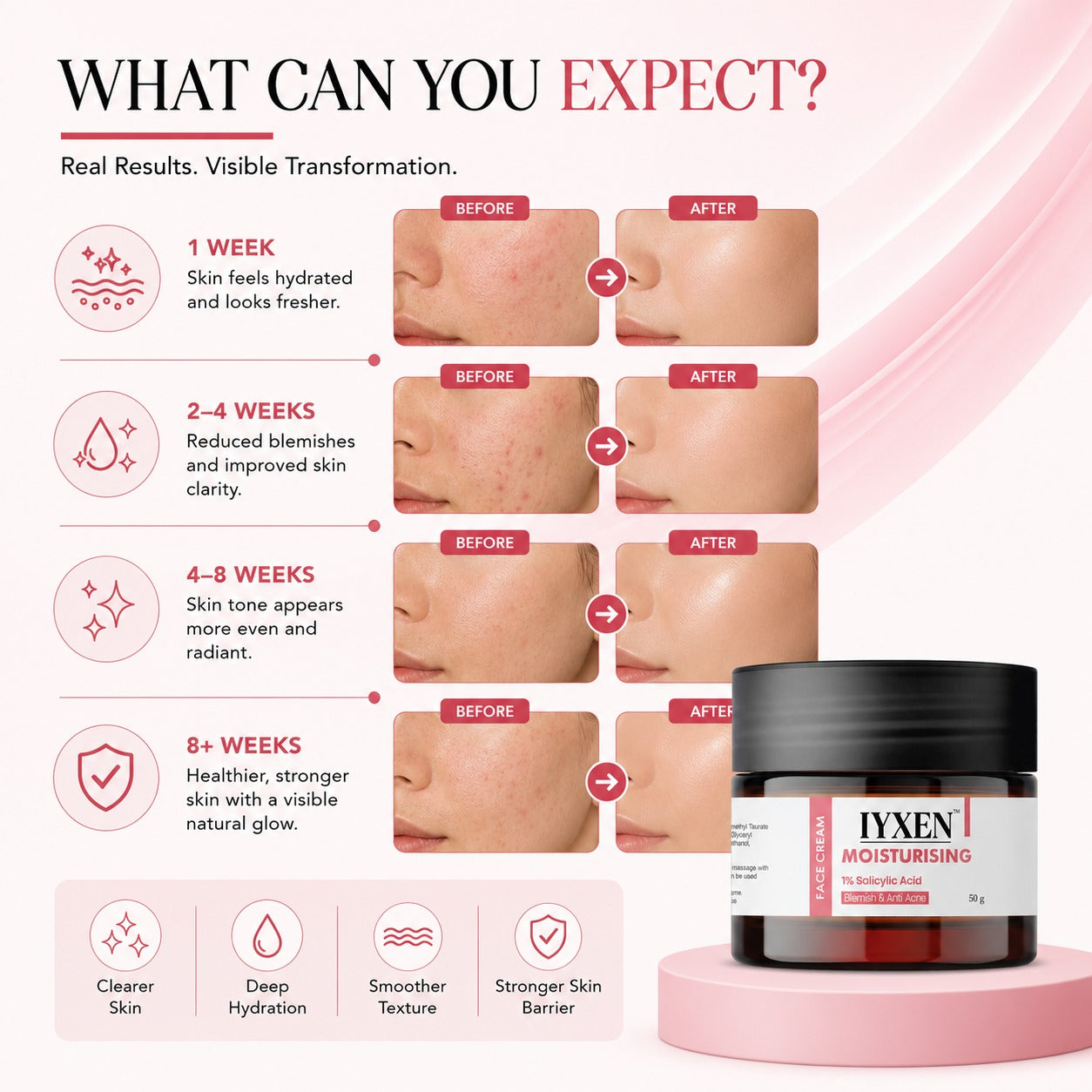 Iyxen 1% Salicylic Acid Moisturising Face Cream