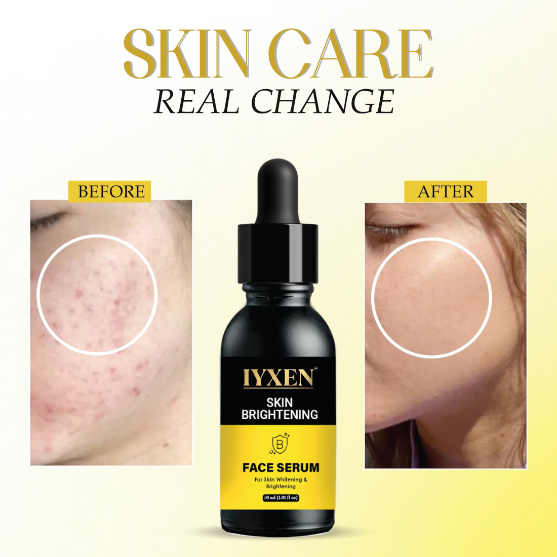 Iyxen Skin Brightening Whitening Face Serum For Dark Spots
