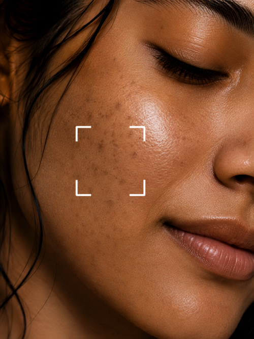 Dark Spot and Pigmentation