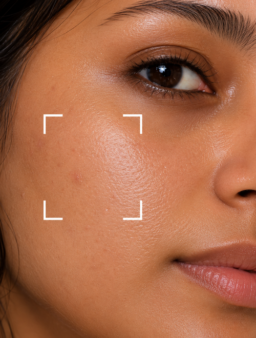 Dryness Skin