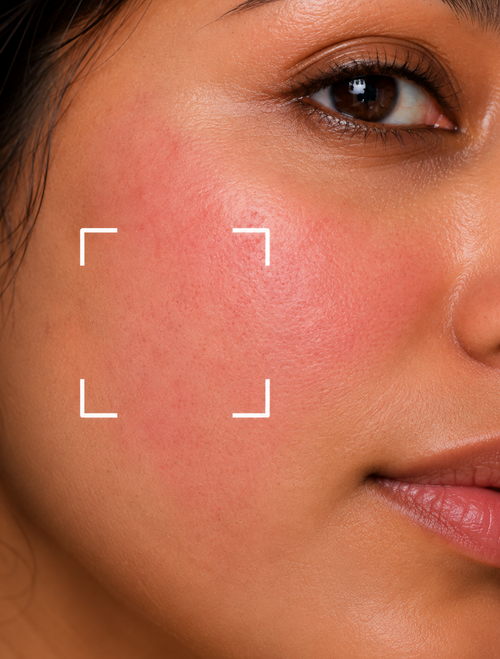 Sun Damage Skin