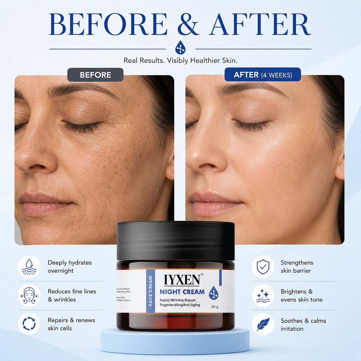 Iyxen Night Cream Rapid Wrinkle Repair Regenerating Anti Aging