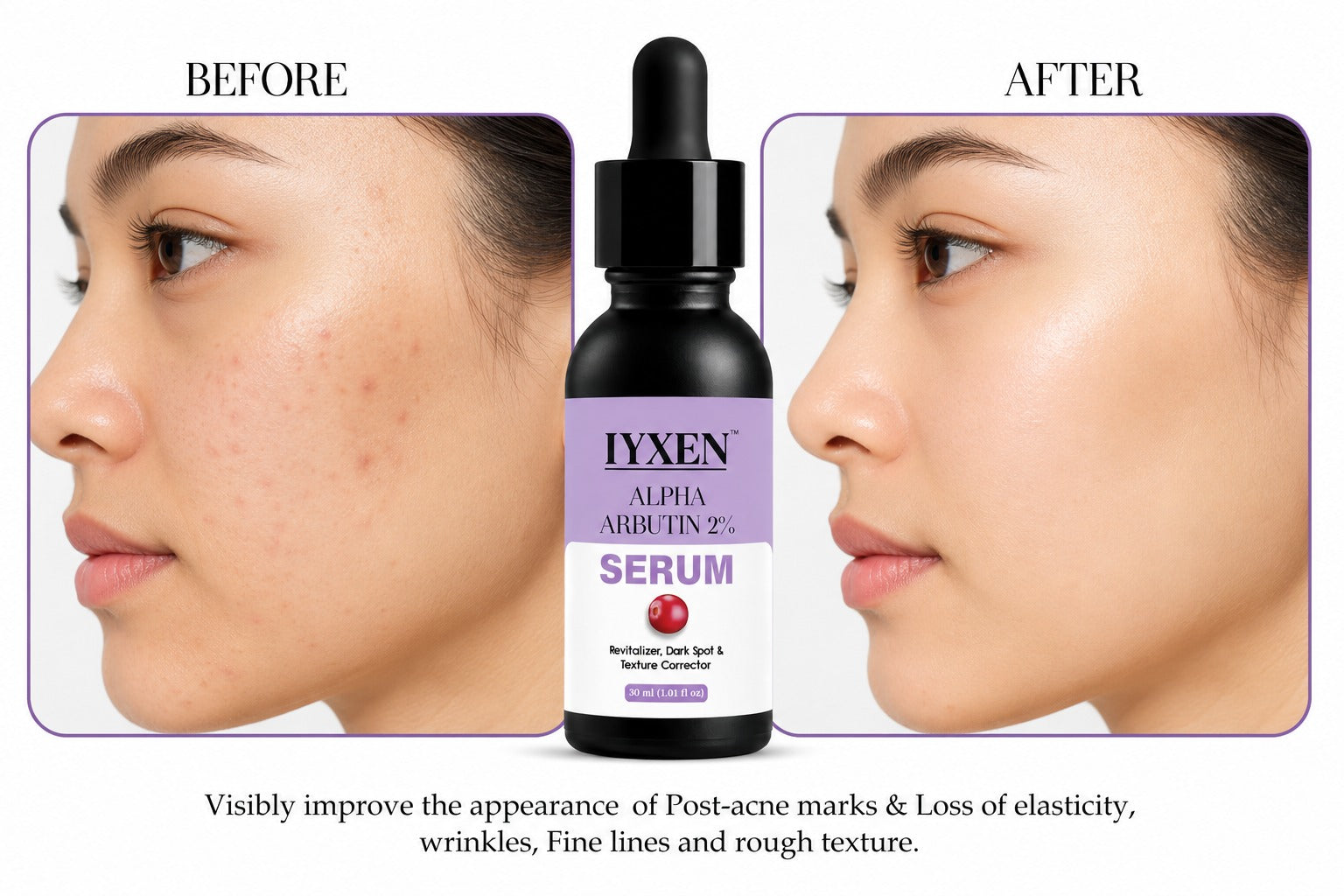 Iyxen Alpha Arbutin 2% + Hyaluronic Acid Dark Spot Face Serum